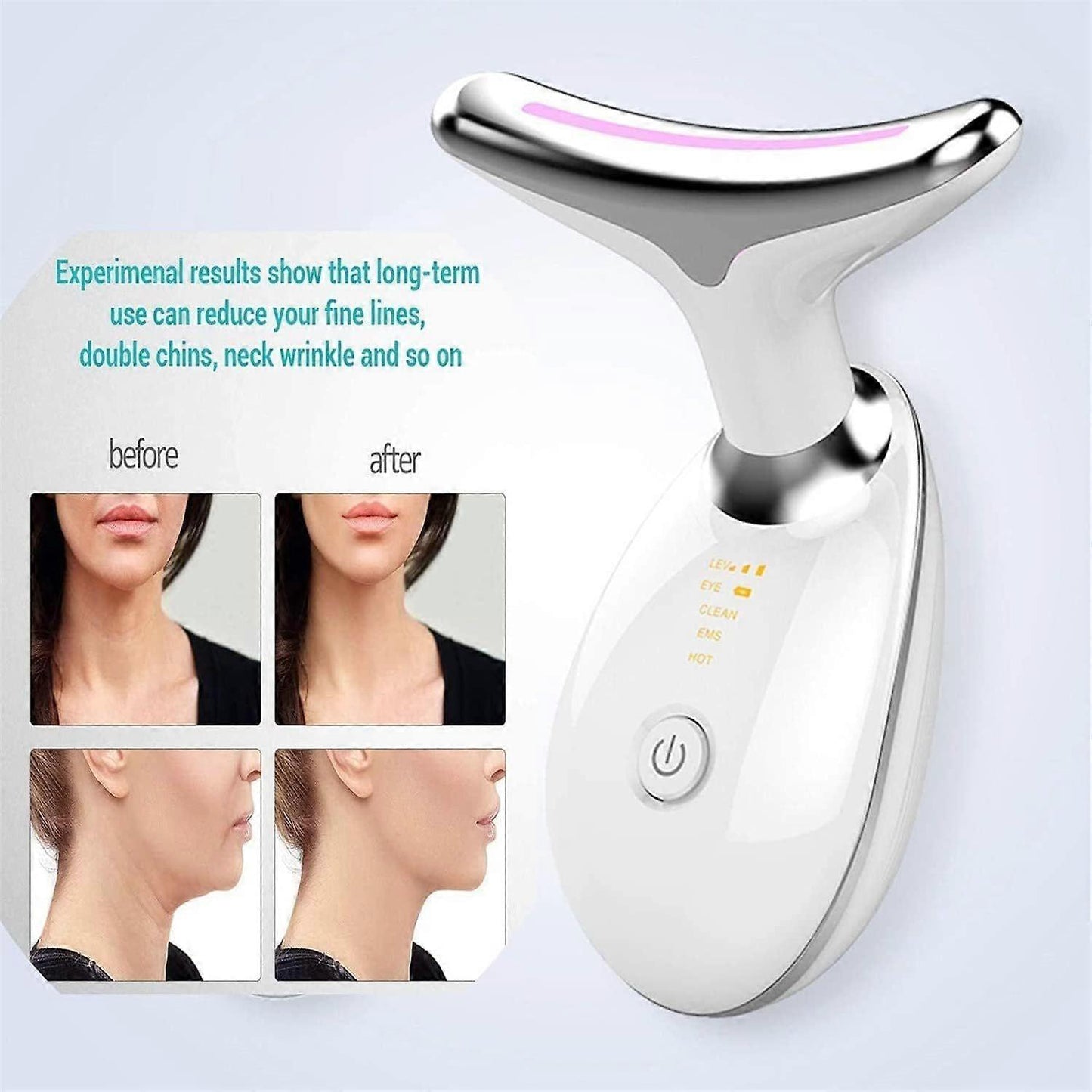 Ziaskin™ SculptLift – Reductor de Papada & Lifting Facial Avanzado